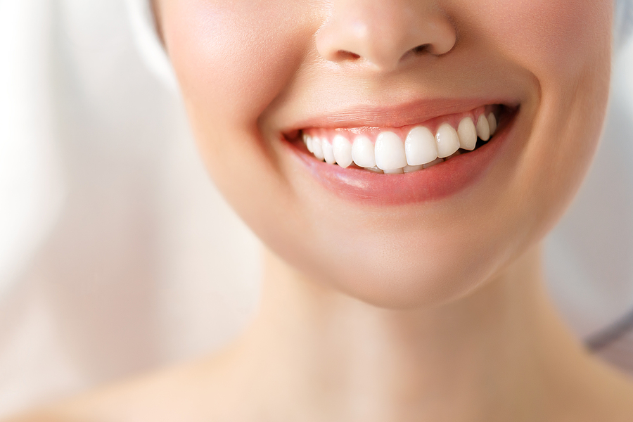 Restoring Your Smile: Comprehensive Guide to Crowns and Bridges in Denver, NC