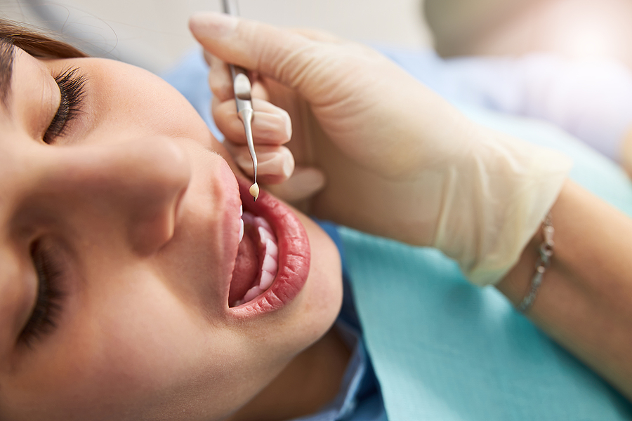 Dry Socket: What It Is and How to Prevent It After a Tooth Extraction