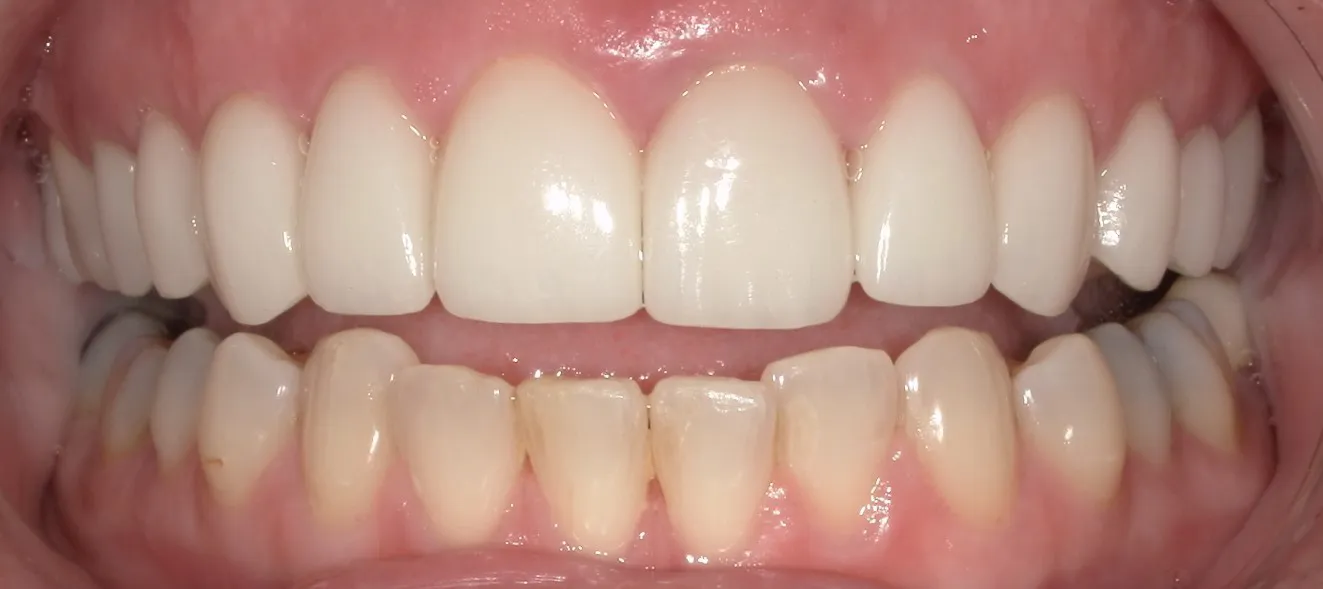 West Lake Dentistry West Lake Dentistry