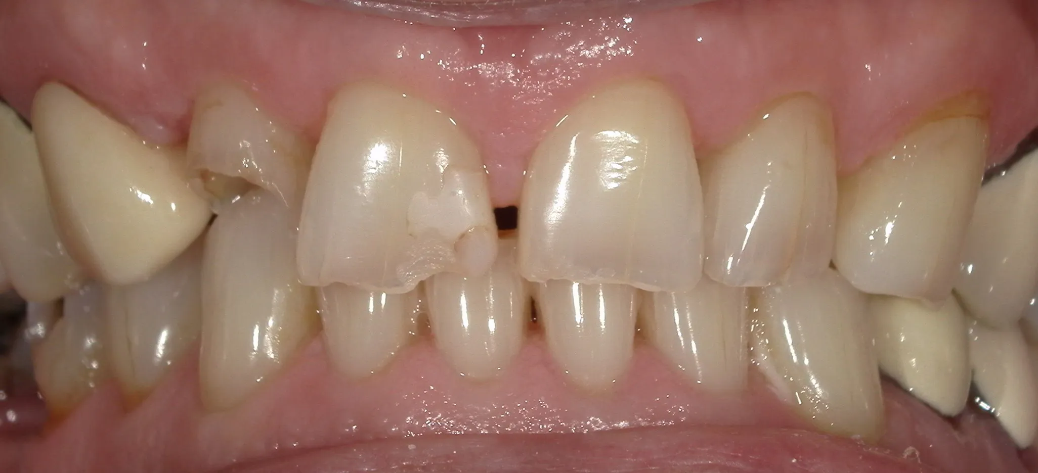 West Lake Dentistry West Lake Dentistry