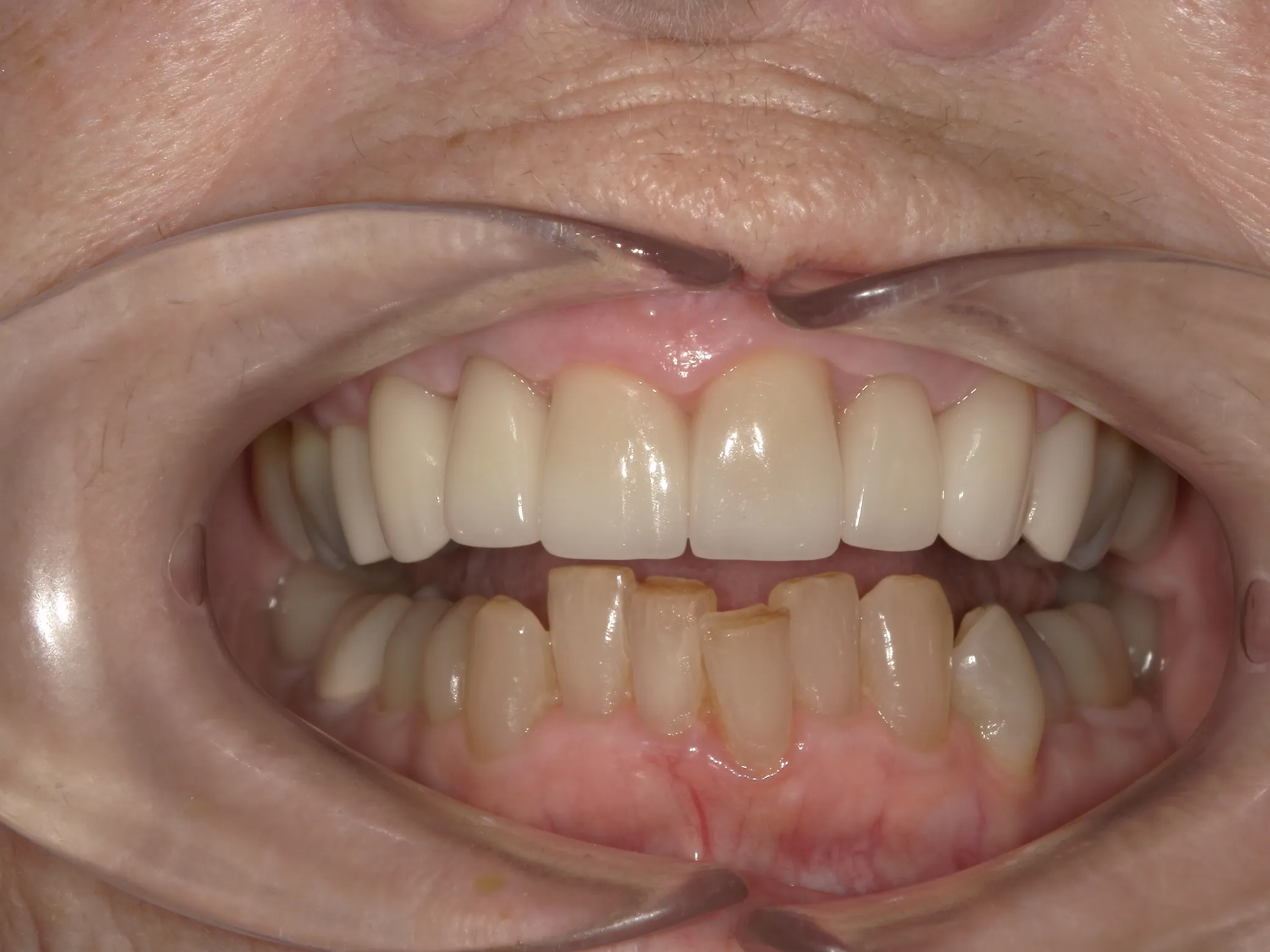 West Lake Dentistry West Lake Dentistry