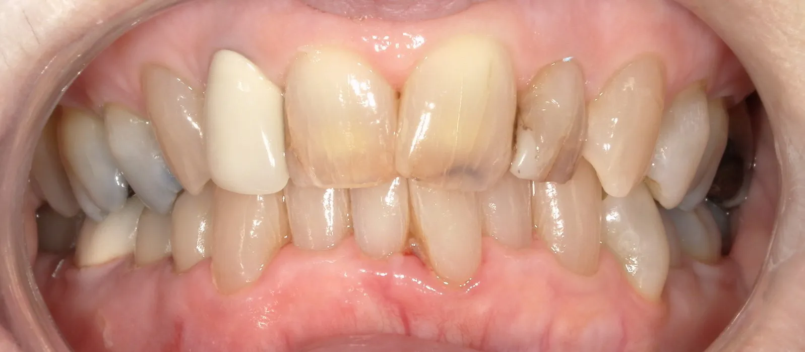 West Lake Dentistry West Lake Dentistry