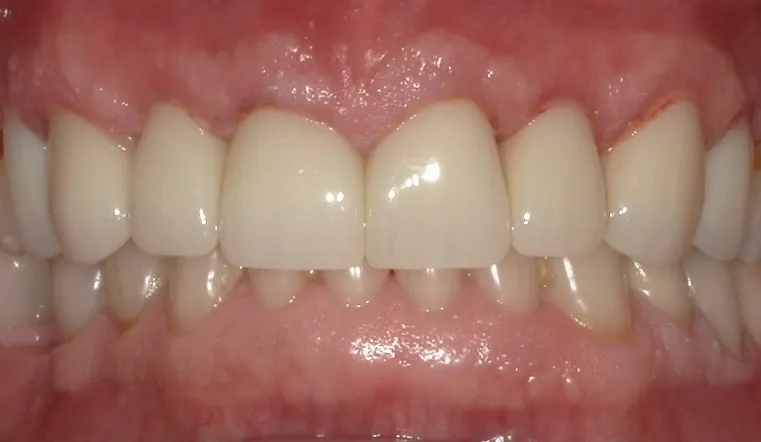 West Lake Dentistry West Lake Dentistry