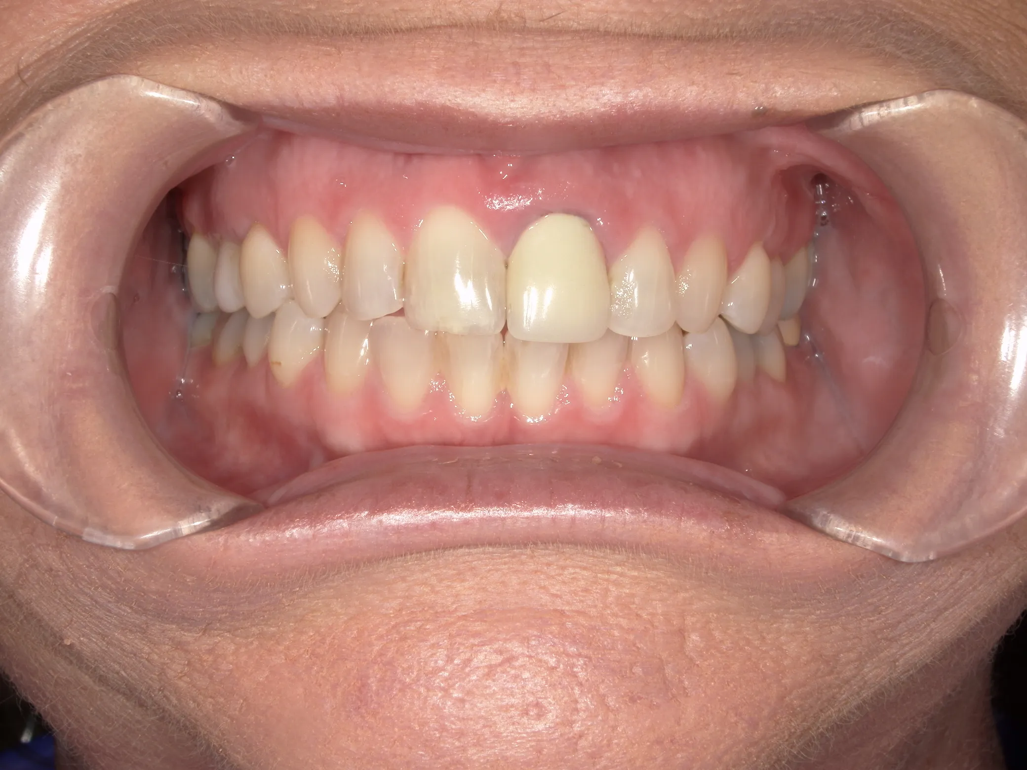 West Lake Dentistry West Lake Dentistry