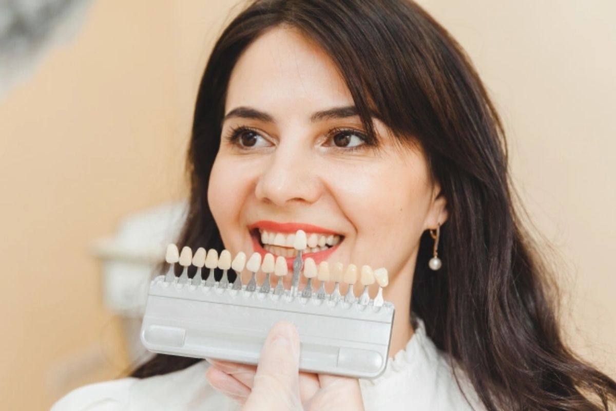 Do Dental Veneers Look Natural? What Patients Should Know